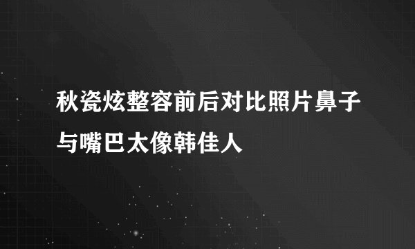 秋瓷炫整容前后对比照片鼻子与嘴巴太像韩佳人