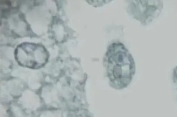 美国再现食脑虫，这种生物是从哪来的？
