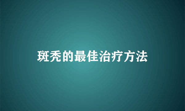 斑秃的最佳治疗方法