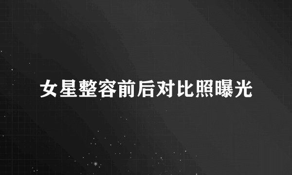 女星整容前后对比照曝光