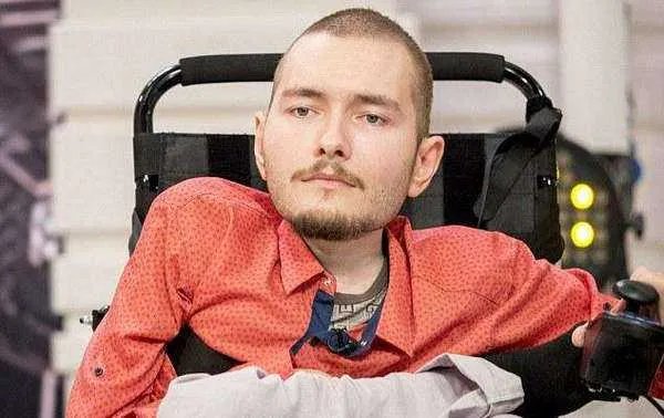 全球首例换头手术后来怎么样了?