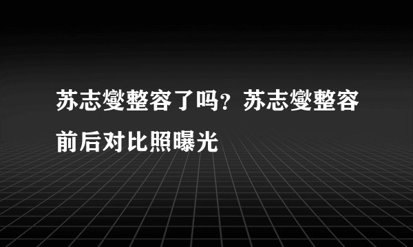 苏志燮整容了吗？苏志燮整容前后对比照曝光