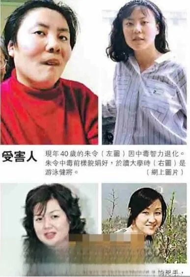 清华大学铊中毒案件 朱令案同宿舍的人现状如何