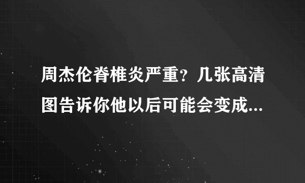 周杰伦脊椎炎严重？几张高清图告诉你他以后可能会变成什么样子