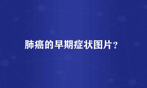 肺癌的早期症状图片？