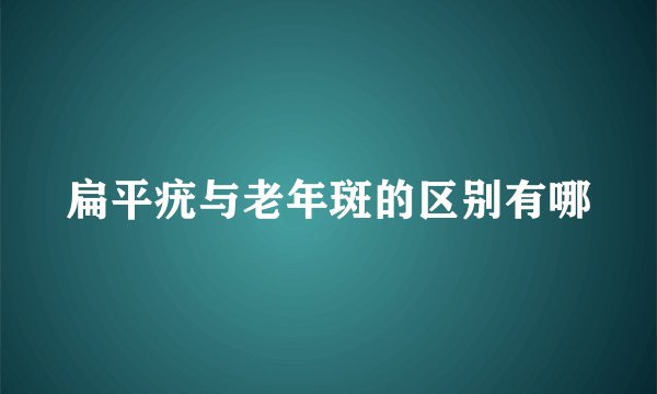 扁平疣与老年斑的区别有哪