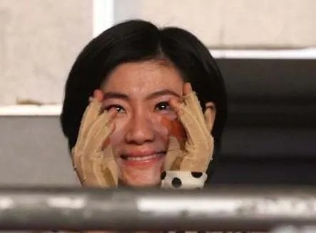 selina烧伤事件原因盘点 其烧伤惊人内幕