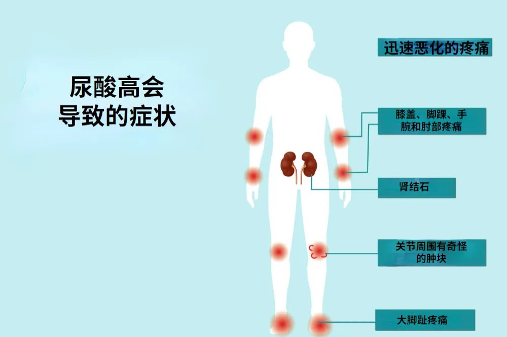 尿酸高有哪些症状图片